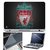 FineArts Laptop Skin 15.6 Inch With Key Guard & Screen Protector - Liverpool