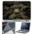 FineArts Laptop Skin 15.6 Inch With Key Guard & Screen Protector - Dont Give Up
