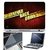 FineArts Laptop Skin Never Back Down With Screen Guard and Key Protector - Size 15.6 inch