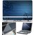 Finearts Laptop Skin Hp On Blue With Screen Guard And Key Protector - Size 15.6 Inch
