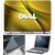 Finearts Laptop Skin Dell World Leader With Screen Guard And Key Protector - Size 15.6 Inch