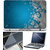 Finearts Laptop Skin 15.6 Inch With Key Guard & Screen Protector - Blue Grey Abstract