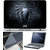 Finearts Laptop Skin 15.6 Inch With Key Guard & Screen Protector - Black Spider Chest