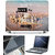 Finearts 3 In 1 Laptop Skin With Screen Protector And Key Guard