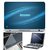 Finearts Laptop Skin 15.6 Inch With Key Guard  Screen Protector - Lenovo Blue