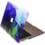 Heartly Printed MacBook Flip Thin Hard Shell Rugged Armor Hybrid Bumper Back Case Cover For MacBook Pro 13 inch With R