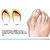 Silicone toe separator with forefoot pad for corn protection 1pair, bunionrelief
