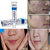 BioAQUA Anti-Acne Top Treatment, Pimple  Scar Removal Clean  Clear Skin Cream