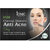 Ionic MSM Charcoal Anti Acne Soap