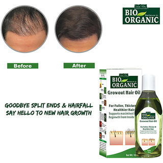 Buy Herbal Hair Regrowth Oil Hair Oil Hair Growth Regrowth Treatment Anti Hair Fall Solution Online Get 21 Off