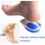 Silicone Heel Cup Pads for Bone Spurs Pain Relief Protectors of Your Sore