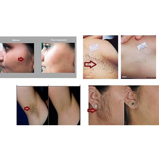 Thanaka Powder Grade Eins 100gm Kusumba Oil100ml For Permanent Hair Removal Haleys