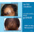 Hair Fibers-Hair Regrowth,Anti Hair Loss -Imported From China