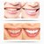 New Tooth Whitening Gel Pen Whitener Cleaning Bleaching Kits Dental Teeth White Pink H4