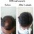 Caboki Hair Building Fibers 25Gm  Pack Of 3 Black -Best Seller Best Quality At Best Rate