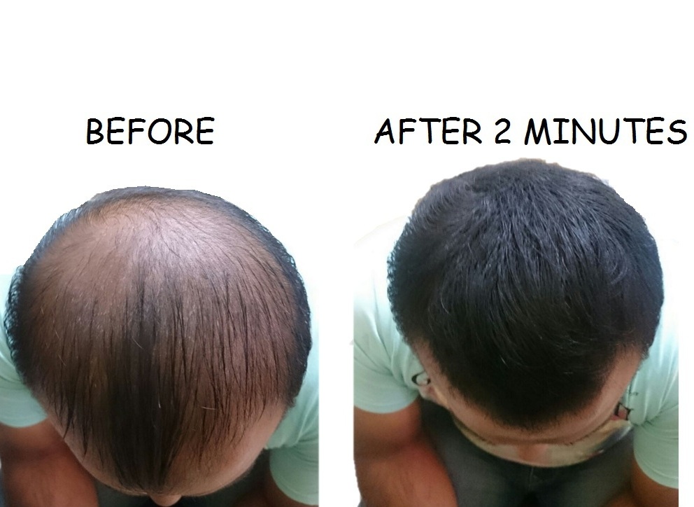 Buy Toppik Hair Building Fiber 27.5 Gm Free 12 Gm Confi Refill Pack Online ₹1099 from ShopClues