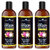 Park Daniel ONION Herbal Hair oil - For Hair Regrowth and Anti Hair Fall Combo pack of 3 bottles of 100 ml(300 ml)