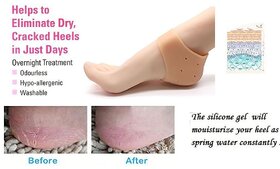 Eastern Club silicon anti crack heel pain relief moisturizing socks for Men and Women 1 Pair