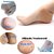 Eastern Club Silicone Gel Heel Pad Socks for Pain Relief for Men and Women (Beige, Free Size) - 1 Pair