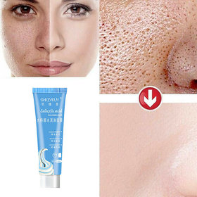 Salicylic Acid Ultra Cleansing  Ice Cream Facial Mask Reduce Acne Marks and Blackheads Moisturizing 120ml