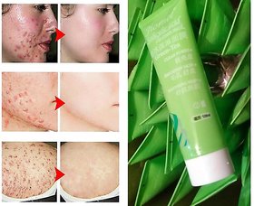 Tea tree Salicylic Acid Ultra Cleansing Mask Ice Cream Facial Mask Reduce Acne Marks and Blackheads Moisturizing 120ml