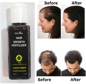 Hair Fertilizer To Growth  Reborn Of All Type Of hair