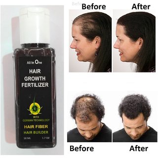 Hair Fertilizer To Growth  Reborn Of All Type Of hair