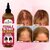 FEMALE BALDNESS (HAIR OIL) (BALDHEAD TREATMENT OIL FOR WOMEN)