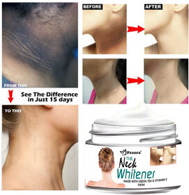 Whitening  Lightening Cream for Removal of Hyperpigmentation For Dark body parts like neck ankles Arms Body Part