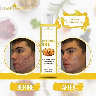                       PARK DANIEL Premium Cold Pressed Wheatgerm oil(100 ml) (100 ml)                                              