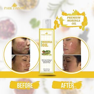                       PARK DANIEL Organic Moringa oil- Natural & Undiluted(100 ml) (100 ml)                                              