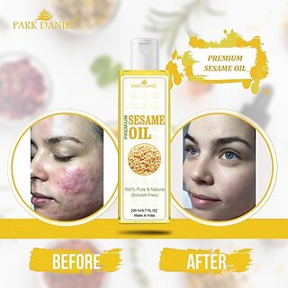                       PARK DANIEL Virgin Sesame Oil- Pure and Natural (100 ml) (100 ml)                                              
