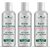 PARK DANIEL  Kills 99.9% Germs without Water Enriched with Aloe Vera & Green Apple Extract Combo Pack of 3 bottles of 100 ml(300 ml) Hand Sanitizer Bottle (3 x 100 ml)