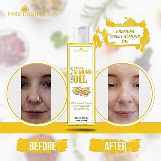                       PARK DANIEL Premium Sweet Almond Oil For Hair Growth (100 ml) Hair Oil (100 ml)                                              