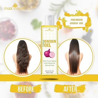                       PARK DANIEL 100% Pure & Natural Onion Seed oil(100 ml) Hair Oil (100 ml)                                              