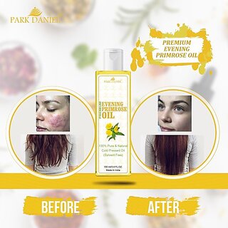                       PARK DANIEL Premium Evening Primrose oil- 100% Pure & Natural(100 ml) Hair Oil (100 ml)                                              