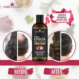                      PARK DANIEL Premium Onion Herbal Hair Oil - For Hair Growth(200 ml) Hair Oil (200 ml)                                              