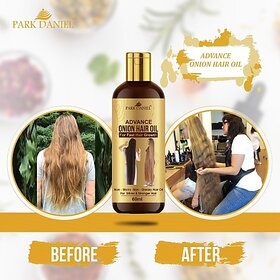 PARK DANIEL Advance Onion Hair Oil |For Reduces hairfall |for faster hair growth & complete nourishment suits all Hair types Hair Oil For Regrowth 60ml Hair Oil (60 ml)