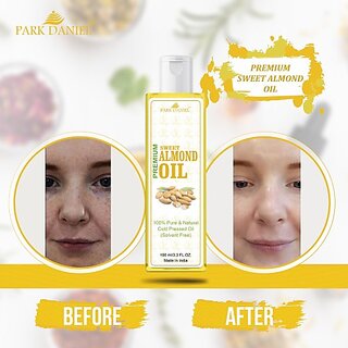                       PARK DANIEL Pure and Natural Sweet Almond Oil(100 ml) Hair Oil (100 ml)                                              