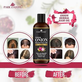                       PARK DANIEL Premium Onion Herbal Hair Oil - Blend of 12 Natural Oils for Hair Regrowth, Treat hair loss, Dandruff Control & Thickens hair Hair Oil (100 ml)                                              
