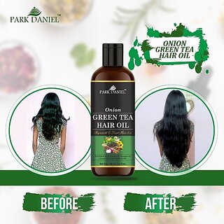                       PARK DANIEL Premium Onion Green Tea Hair Oil Enriched With Vitamin E -For Hair Fall Control (100 ml) Hair Oil (100 ml)                                              