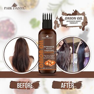                       PARK DANIEL ONION OIL- Intensive Root Therapy With Active Hair Growth Booster Ingredients- For Anti Hair fall & Promotes Hair Regrowth(100 ml) Hair Oil (100 ml)                                              