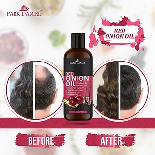                       PARK DANIEL 100% Pure & Natural RED ONION OIL- For Hair Regrowth & Anti Hair fall Hair Oil (60 ml)                                              