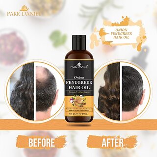                       PARK DANIEL Premium Onion Fenugreek Hair Oil Enriched With Vitamin E -For Hair Growth and Shine (60 ml) Hair Oil (60 ml)                                              