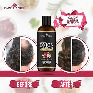                       PARK DANIEL Premium Onion Herbal Hair Oil - For Hair Growth(60 ml) Hair Oil (60 ml)                                              