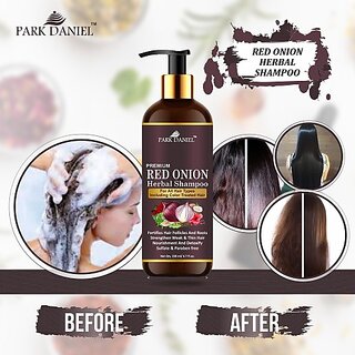                       PARK DANIEL Premium RED ONION OIL Herbal Shampoo- For Hair Growth for all Hair Types including Color treated Hairs(200 ml) (200 ml)                                              