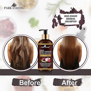                       PARK DANIEL Premium Red Onion Herbal Shampoo - For Anti Hair Fall Pack of 1 of 300 ml (300 ml)                                              