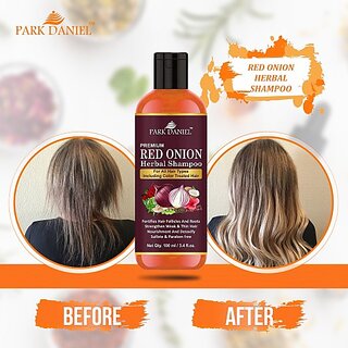                       PARK DANIEL Premium RED ONION OIL Herbal Shampoo For Hair Growth (100 ml)                                              
