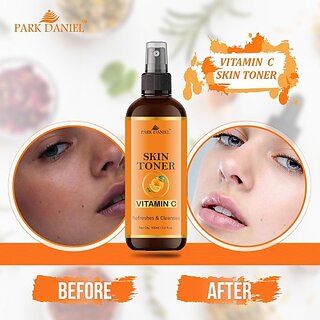                       PARK DANIEL Premium Vitamin C Skin Toner For Men & Women (100 ml) Men & Women (100 ml)                                              