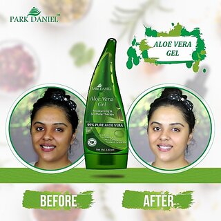                       PARK DANIEL Aloe Vera Gel- For Skin Brightening & Skin Dryness Control(130 ml) (130 ml)                                              